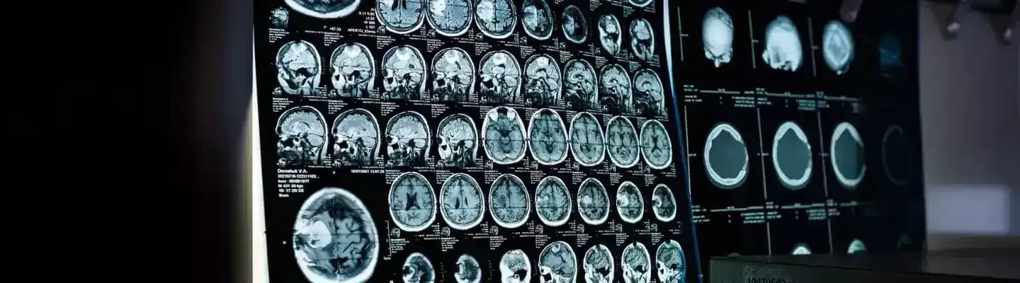 biaya ct scan kepala